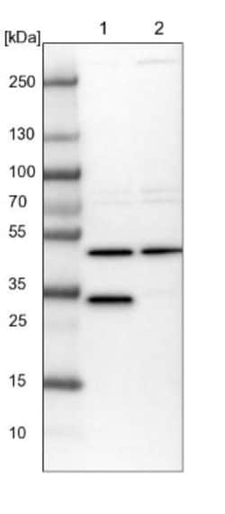 CLYBL Antibody, Novus Biologicals:Antibodies:Primary Antibodies